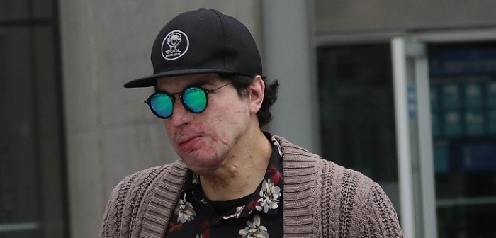 Ignacio Lastra descarta rumores de cirugía en su rostro y asegura que no ingresará a 'Resistiré'