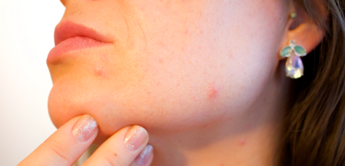 Pocos productos y grandes resultados: los consejos para el cuidado de la piel según su tipo