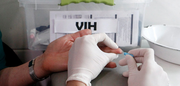 Segundo caso en el mundo: científicos logran remitir VIH en paciente tras trasplante de médula