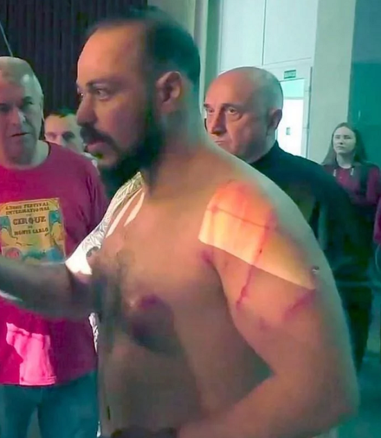 CAPTURA | DAILY MAIL