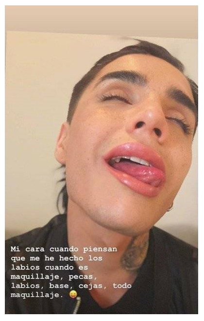 Leo Méndez críticas retoques rostro