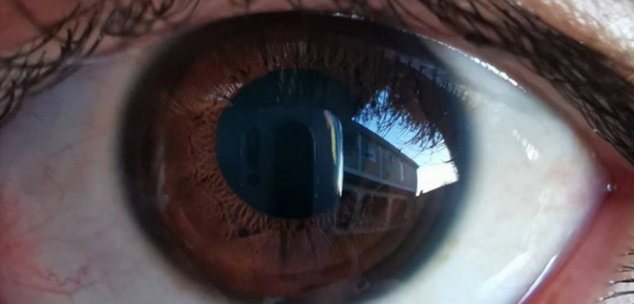 El doloroso caso del hombre al que se le 