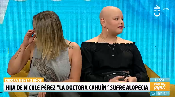 Nicole Pérez alopecia CHV viva la pipol