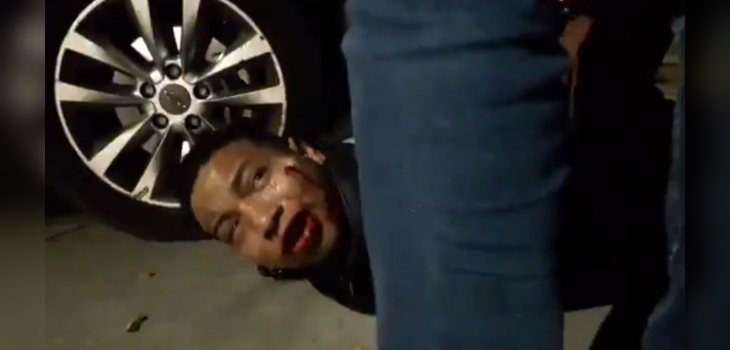 Viralizan video de detención ciudadana en Las Condes: asaltante pedía perdón tras acuchillar a mujer