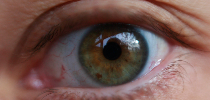 Se equivocó de ojo: oftalmólogo cometió error y para 