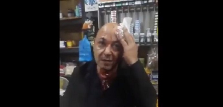 Vendedor de licorería sufrió brutal ataque homofóbico en Talca: Movilh pediría aplicar 'Ley Zamudio'