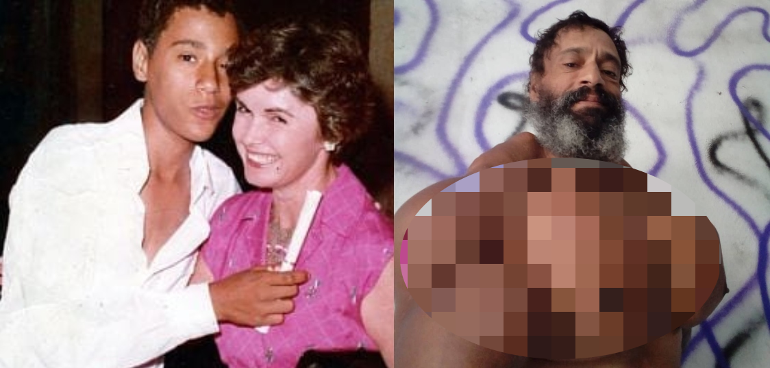 Hombre se inyectó aceite en sus bíceps para ser como Hulk: estuvo al borde de sufrir una amputación