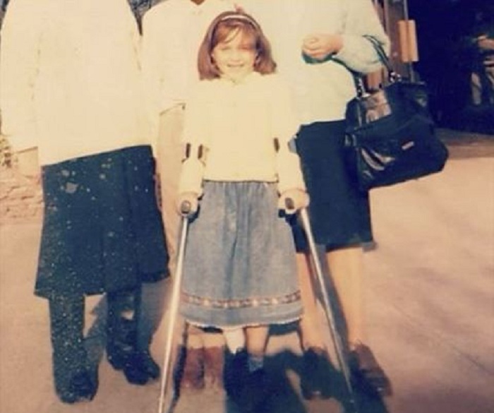 poulette reinoso niña con muletas