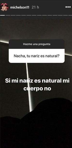 Ignacia Michelson  reveló a qué operaciones estéticas se ha sometido