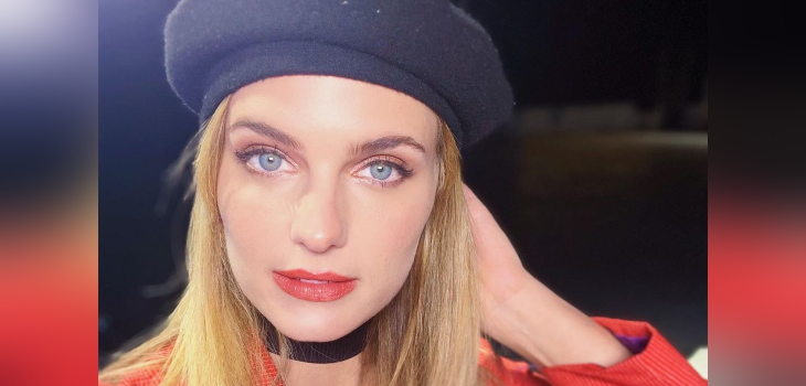 Josefina Montané sufrió inesperado accidente tras usar ventosa facial: le quedó marca en el rostro