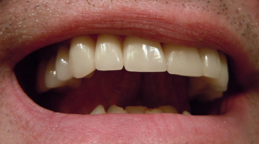 ¿Cómo llegó hasta ahí? El curioso caso de joven que le encontraron una muela dentro de su testículo