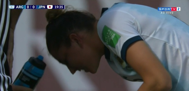 Jugadora argentina perdió un diente tras brutal codazo en el mundial de Francia: continuó jugando