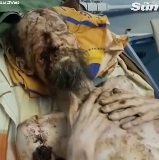 sobreviviente de ataque de oso pardo