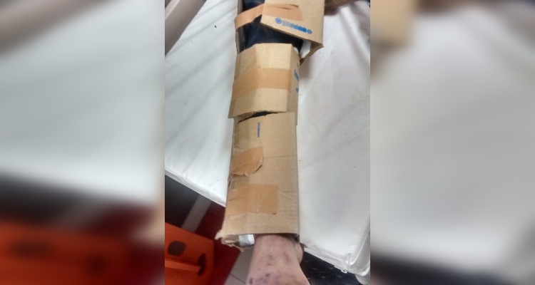 Hombre acusa que inmovilizaron su pierna fracturada con cartón y scotch en hospital capitalino