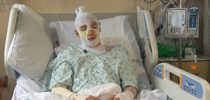 Joven rescató a su sobrina en incendio y quedó internado con graves quemaduras: 