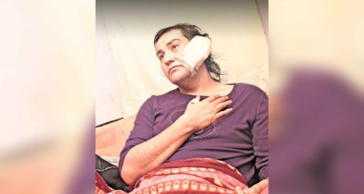 Mujer trans fue víctima de agresión homofóbica en Ñuble: le cortaron la cara y oreja con un machete