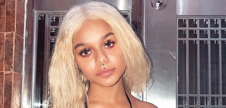 Influencer quedó calva tras mezclar dos tratamientos capilares: transmitió todo por Instagram