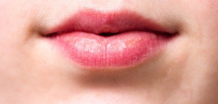 cuidado de labios del frio