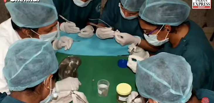 Niño de 7 años fue al dentista por un dolor de mandíbula: terminaron sacándole 526 dientes