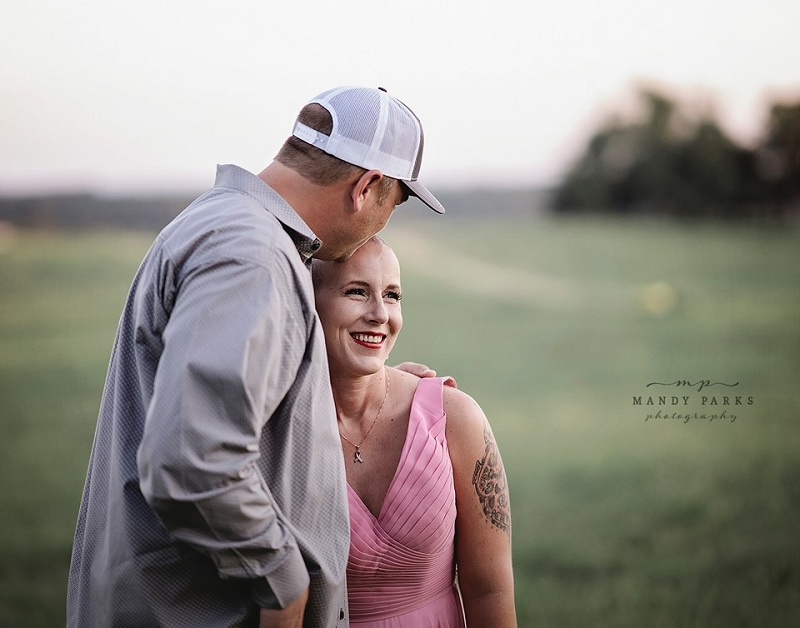 Enfermera con cáncer de mama dejó que su esposo la rapara en sesión de fotos: quiere dar esperanza