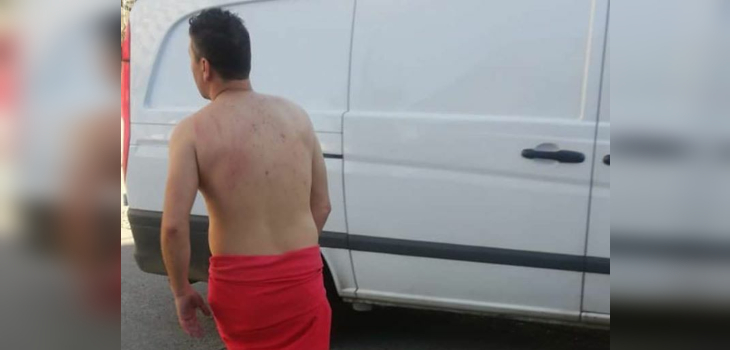 Hombre huyó desnudo de un prostíbulo en Viña del Mar: vecinos denuncian que no es el único escándalo