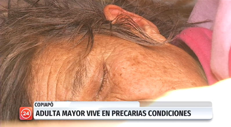 Anciana de 78 años vive postrada en Copiapó