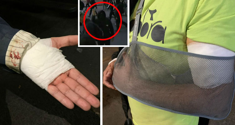 Gobierno repudió agresión a periodistas apuñalados en marcha: 