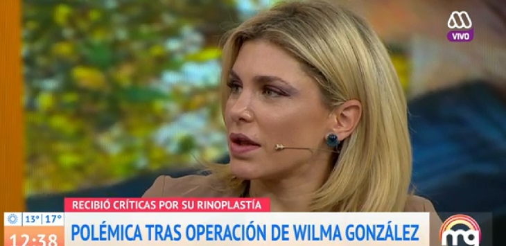 Wilma González reveló la sentida petición que le hizo su hijo tras polémica por su rinoplastía