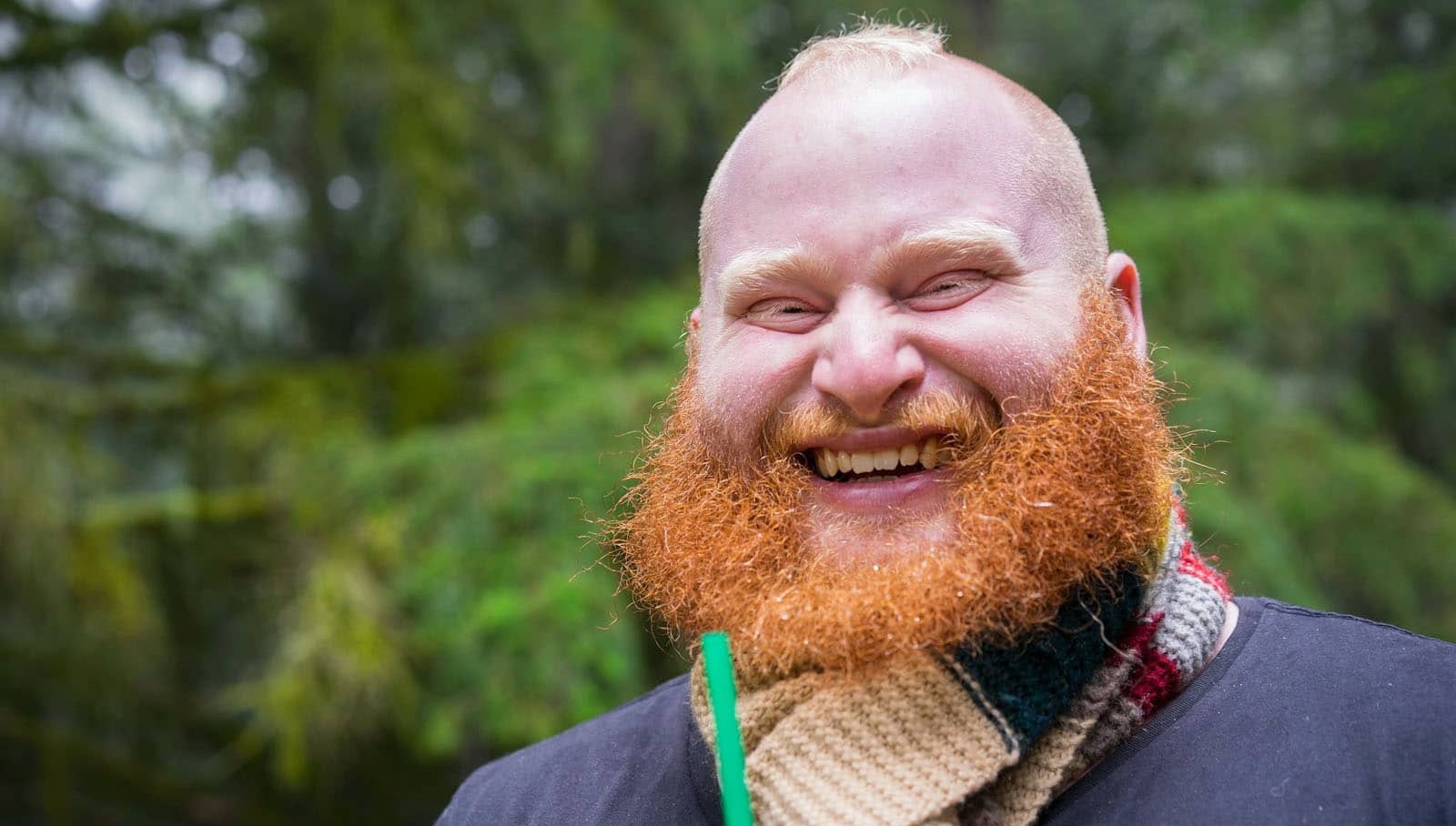 Hombre murió por inyectarse silicona en los genitales tras integrarse a 