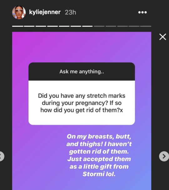 Kylie Jenner | Instagram 1