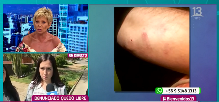 Universitarias fueron víctimas de brutal agresión por fumar afuera de una vivienda en Viña del Mar