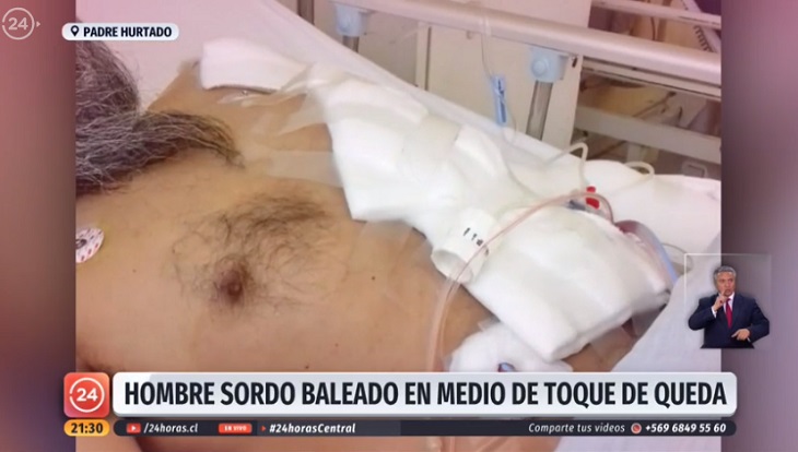 hombre sordo baleado