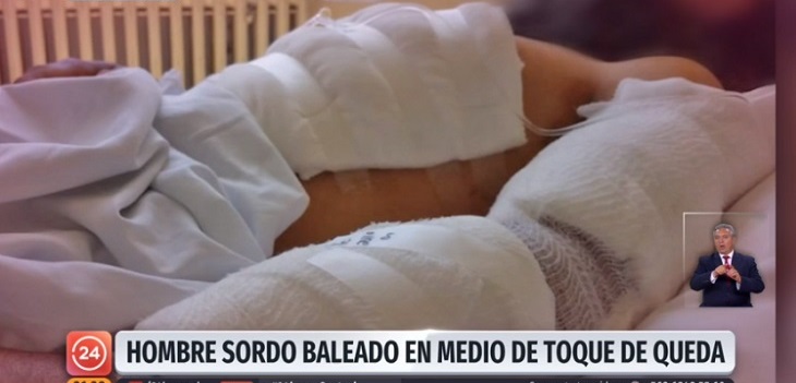 Hombre sordo recibió 30 balines por parte de Carabineros durante toque de queda en Padre Hurtado