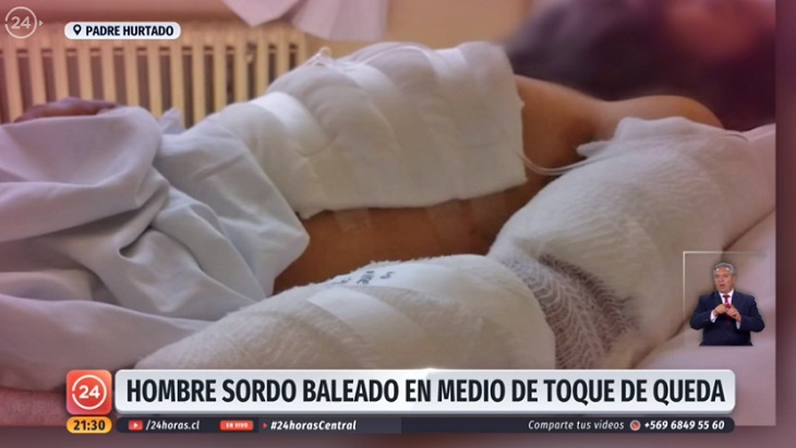 hombre sordo baleado