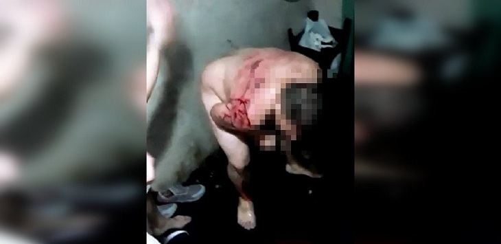 reo torturado colina 1