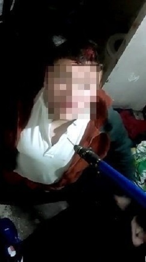 reos torturados en colina 1