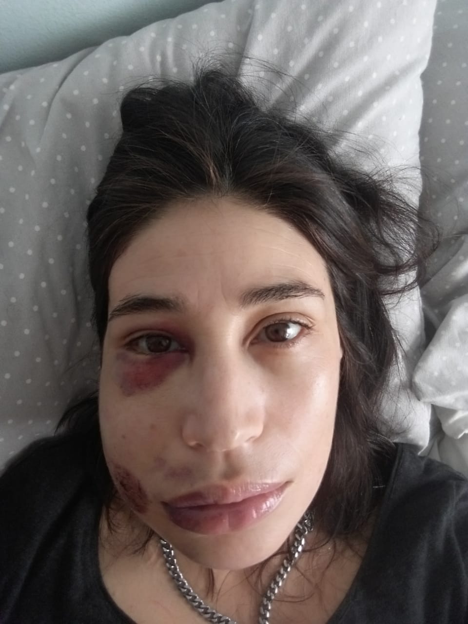 María Paz Grandjean pide justicia tras recibir balín