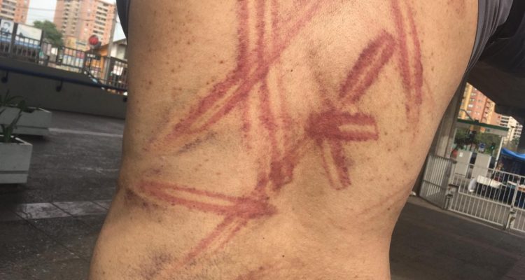 Hombre denuncia golpiza y robo de Carabineros en Puente Alto: 