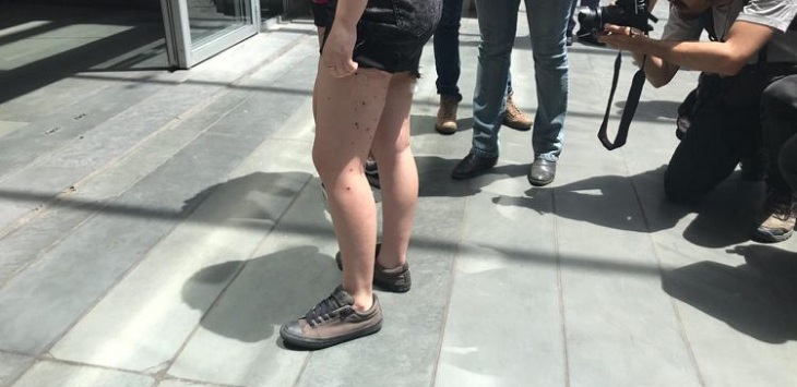 Alumnas heridas en Liceo 7 desmienten a carabinero imputado: