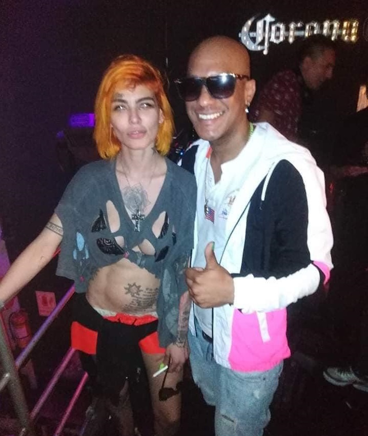 El preocupante aspecto de Angie Jibaja