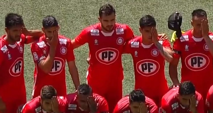 La divertida forma con la que jugador de Calera explicó por qué no tapó su ojo como sus compañeros