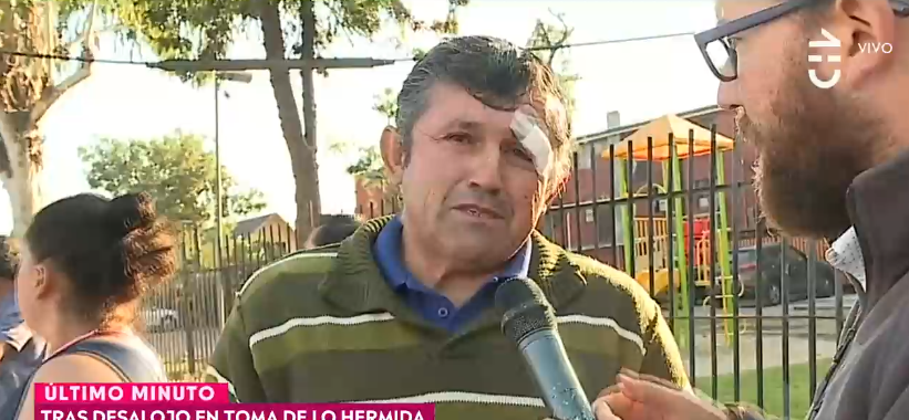 Vecino de Lo Hermida se quebró en CHV tras relatar momento en que perdigón impactó en su rostro