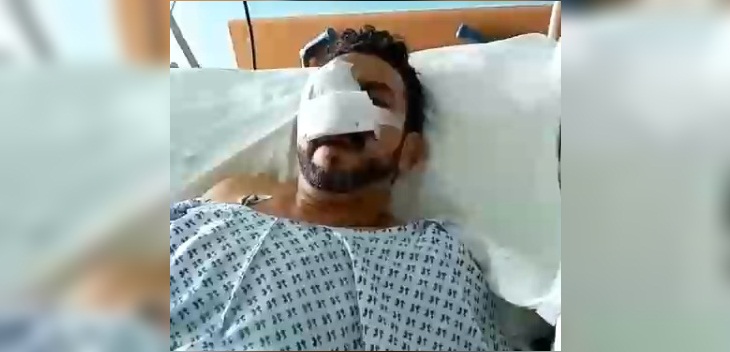 Denuncian que hombre perdió un ojo tras recibir bomba lacrimógena en la cara en Santiago