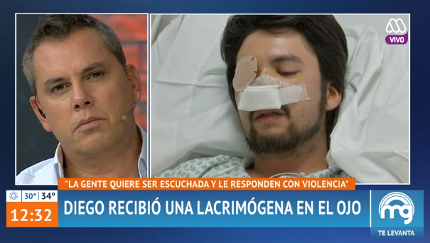 Relato de joven que perdió un ojo por el impacto de bomba lacrimógena impactó en Mucho Gusto