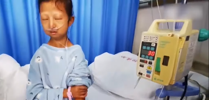 La cruda historia de joven china que por 5 años solo comió arroz y ají: llegó a pesar 20 kilos