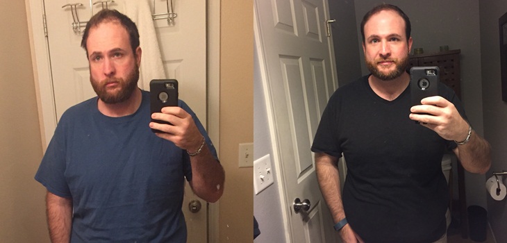 Hombre se fotografió cada mes desde que dejó el alcohol y transformación en 3 años es impresionante