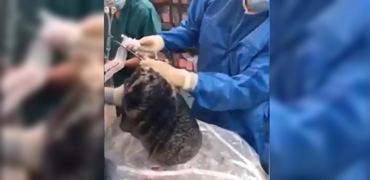 Hombre donó sus pulmones al fallecer pero su decisión fue en vano: estaban completamente negros