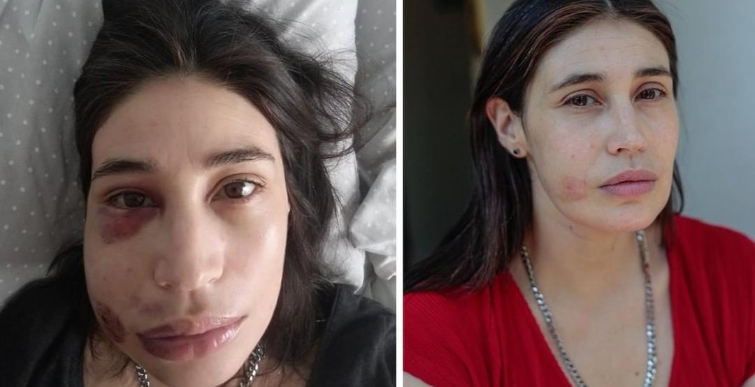 INDH se querella contra Carabineros por apremios ilegítimos sufridos por actriz María Paz Grandjean