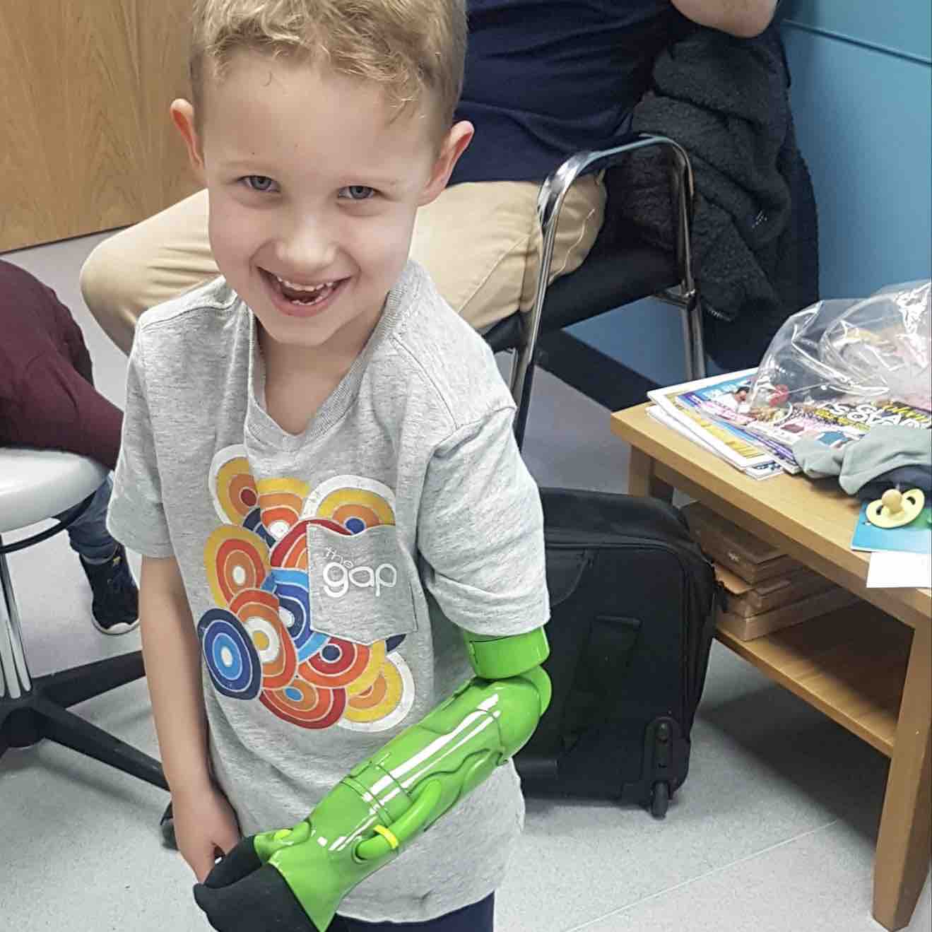 Niño pudo tomar la mano de su papá y hermano por primera vez tras recibir prótesis inspirada en Hulk