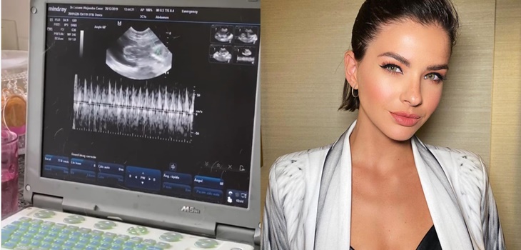 El video de una ecografía en la cuenta de la 'China' Suárez que confundió a todos en Instagram